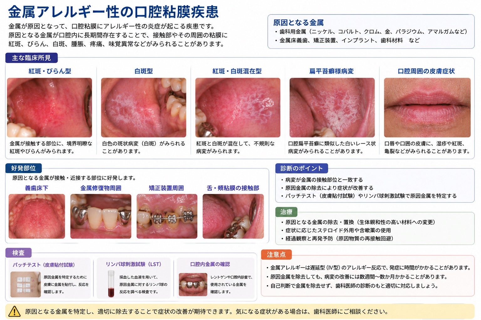 口腔粘膜疾患｜鈴木歯科医院｜守山区の歯医者・歯科
